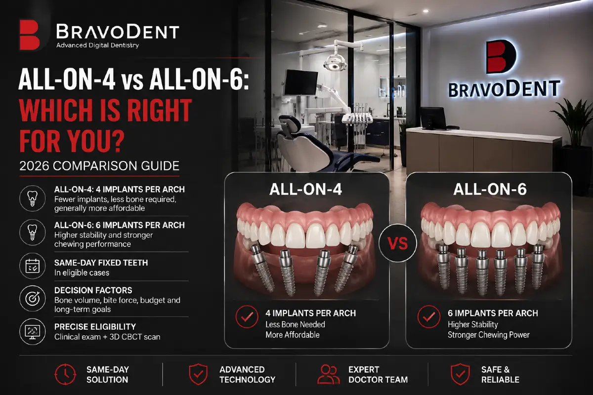 All-on-4 vs All-on-6: Which Is Right for You? 2026 Comparison Guide - Bravodent Diş Kliniği İstanbul
