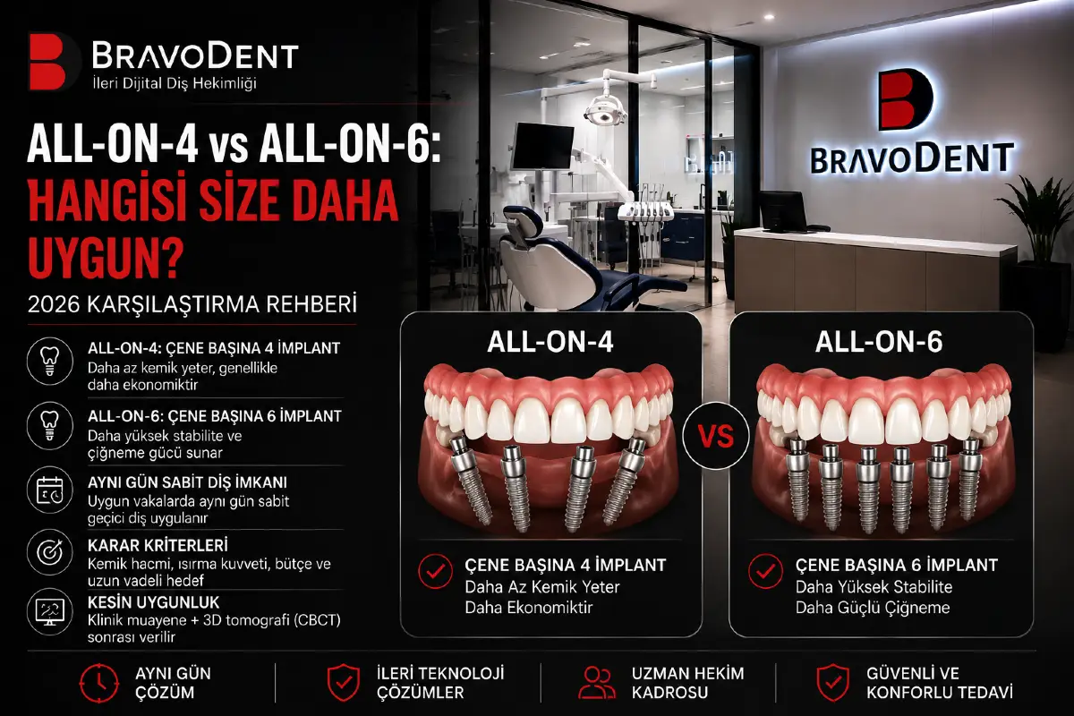 All-on-4 vs All-on-6: Hangisi Size Daha Uygun? 2026 Karşılaştırma Rehberi - Bravodent Diş Kliniği İstanbul