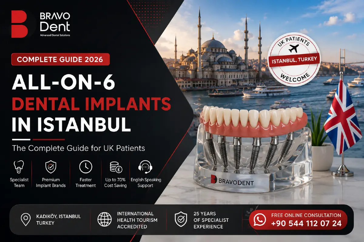 All-on-6 Dental Implants in Istanbul: A Complete Guide for UK Patients