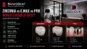 Zirconia vs E.max vs Porcelain-Fused-to-Metal Crowns: Which Is Best? (2026 Guide for International Patients)