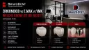 Zirkonoxid vs E.max vs Verblendmetallkeramik: Welche Krone ist die beste? (Ratgeber 2026 für internationale Patienten)